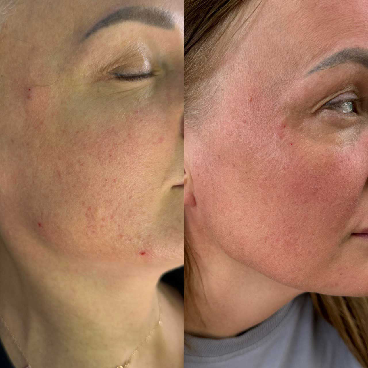 Результат 4