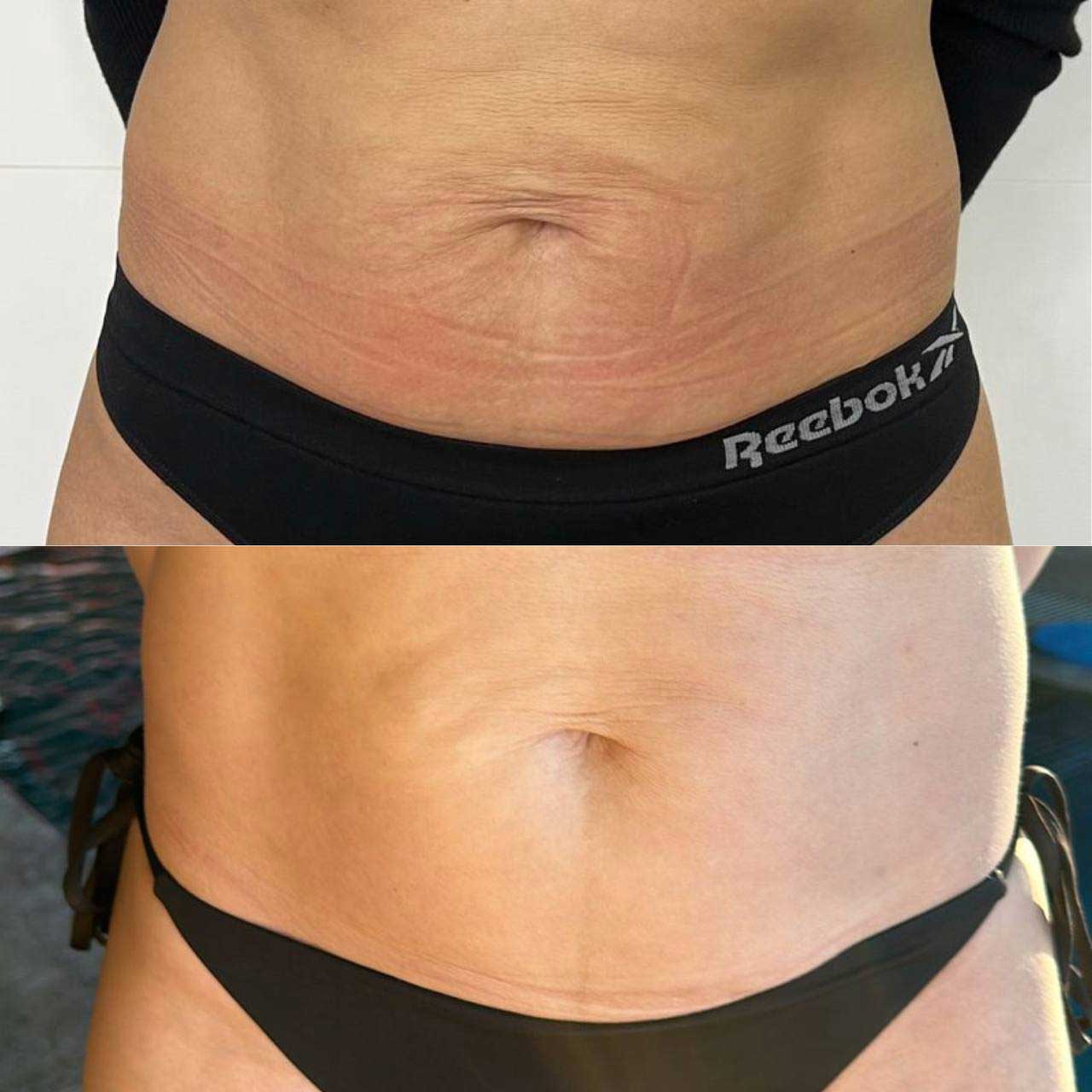 Результат 5