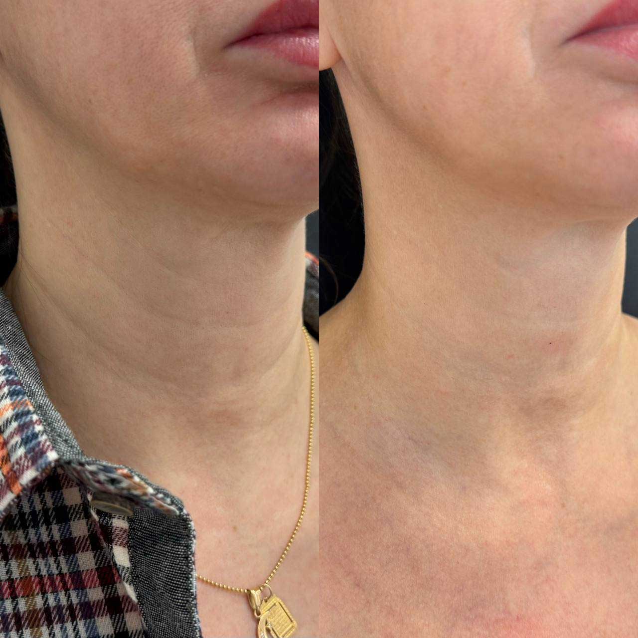 Результат 6