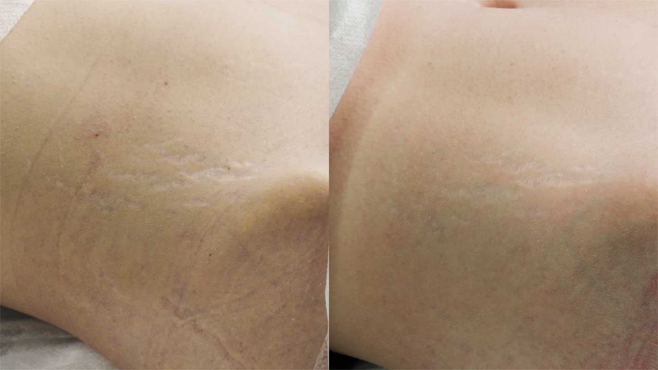 Результат 7