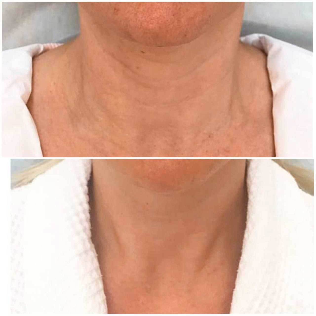 Результат 8