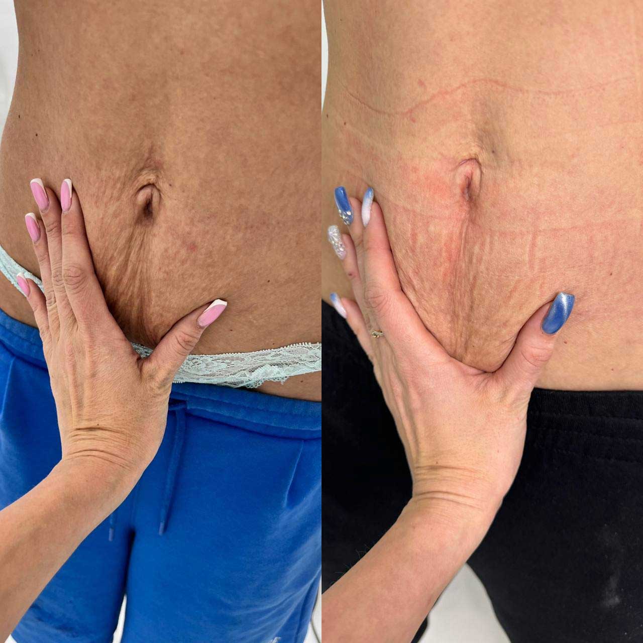 Результат 9